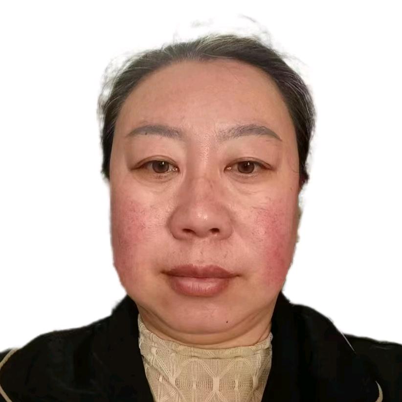 张永芳1