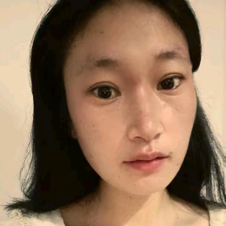 ——冰
