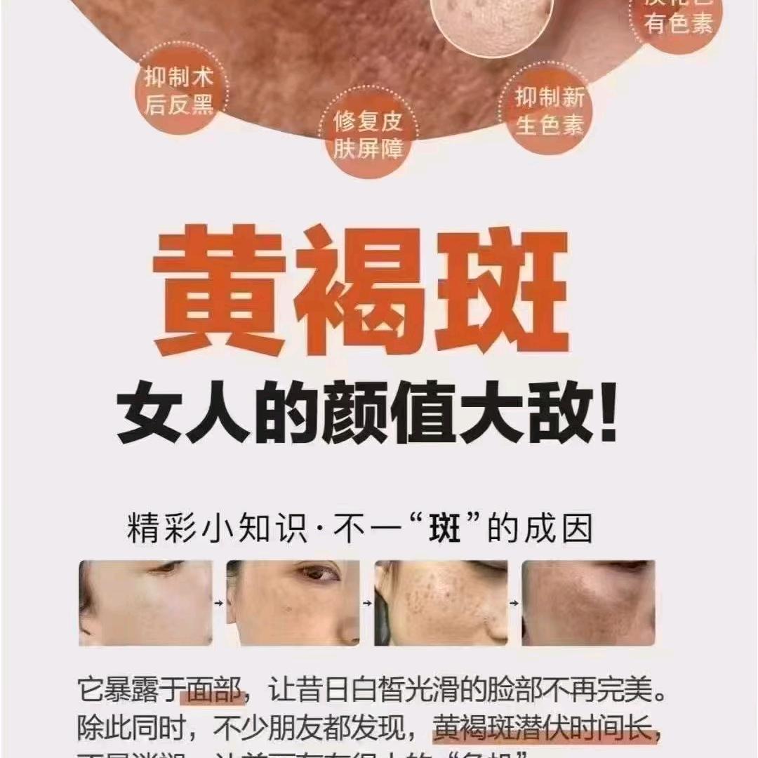 斑敏痘工厂