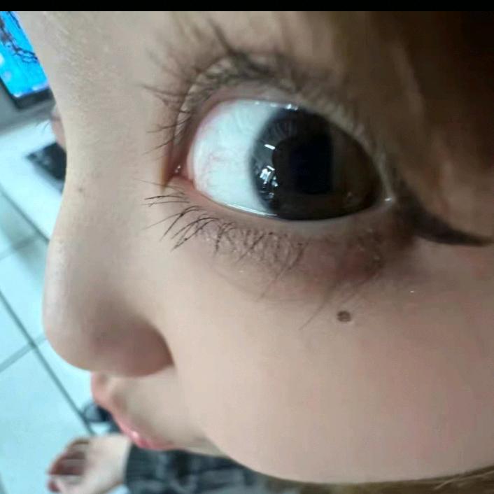 碎片观察
