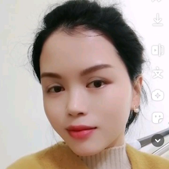 在平江做敏肌痘肌的珊珊