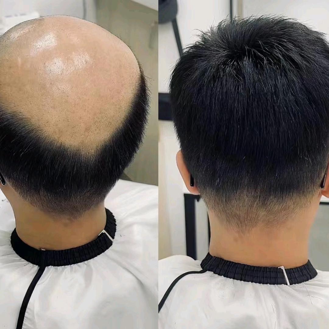 威尼丝假发私人订制（支持上门定制）
