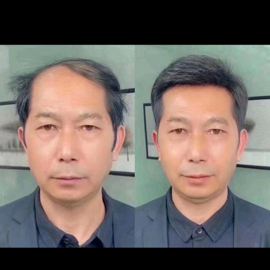 隆昌买假发的大刘