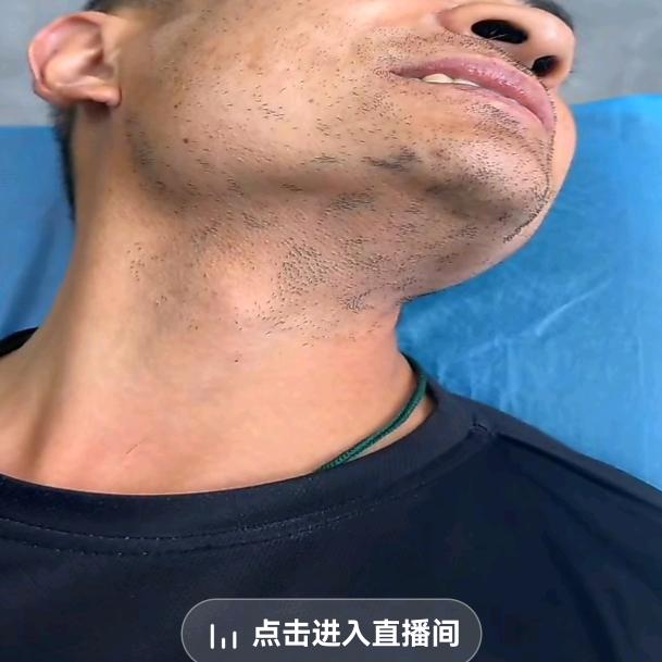 精须堂（告别大胡须）