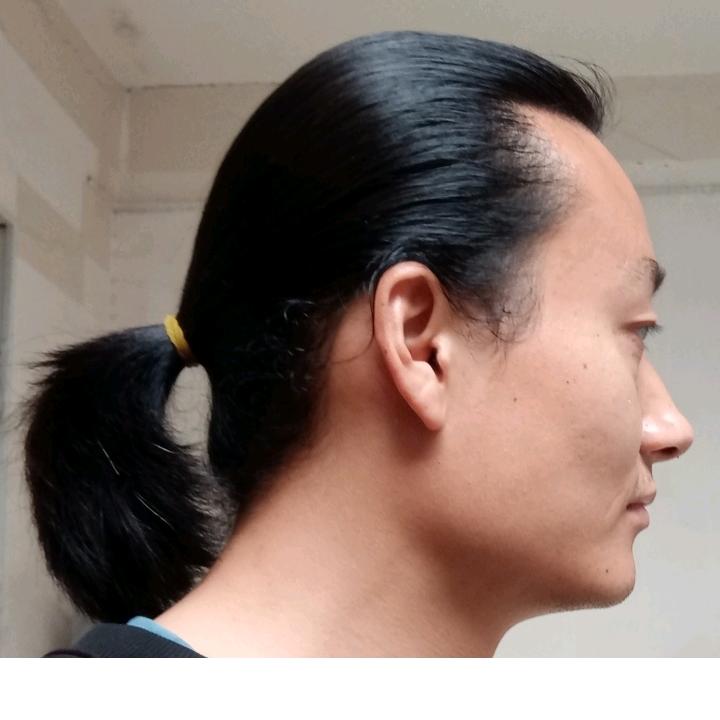 汉唐针灸