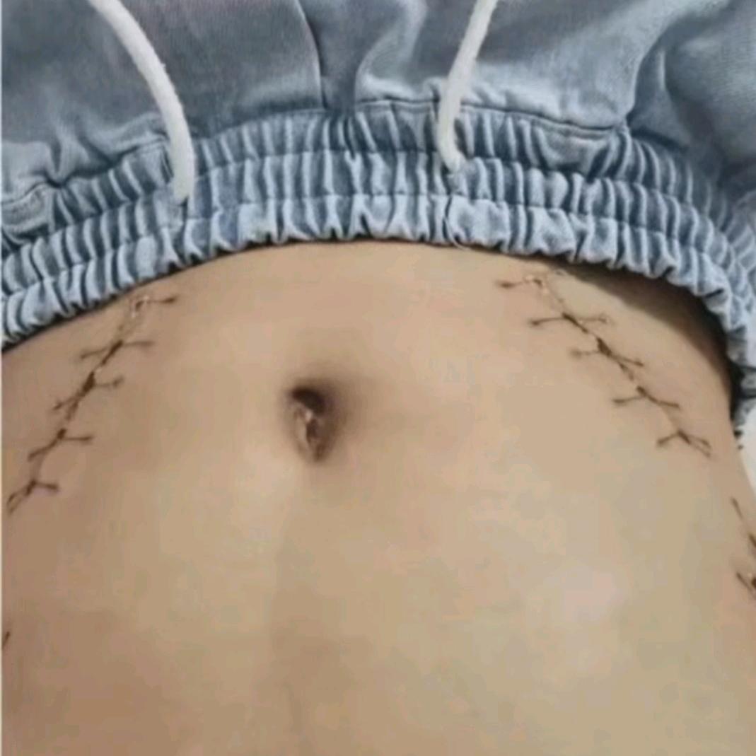 走夜路被掏两个腰子