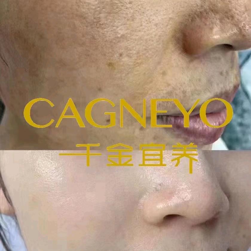 千金宜养，祛斑调肤