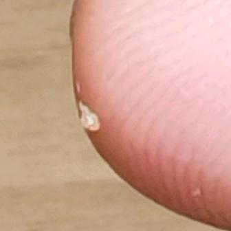 毳毛克星小脂肪