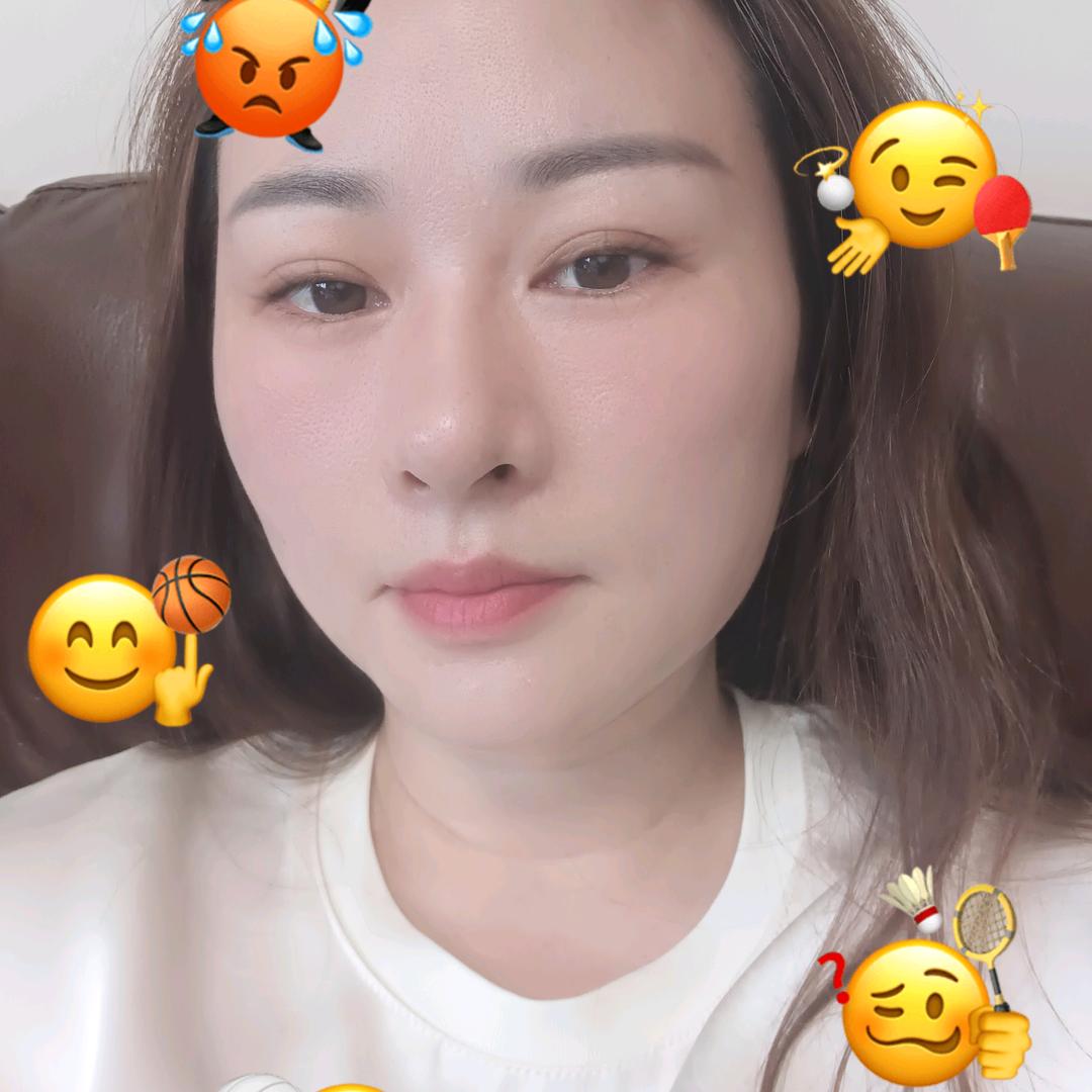 安 妮