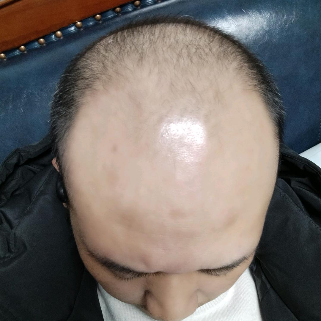 小夏养发（头等大事）