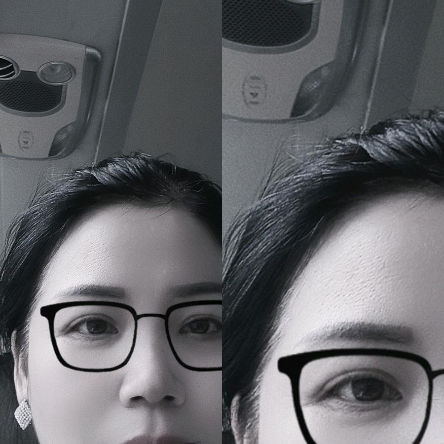 言语康复治疗刘老师