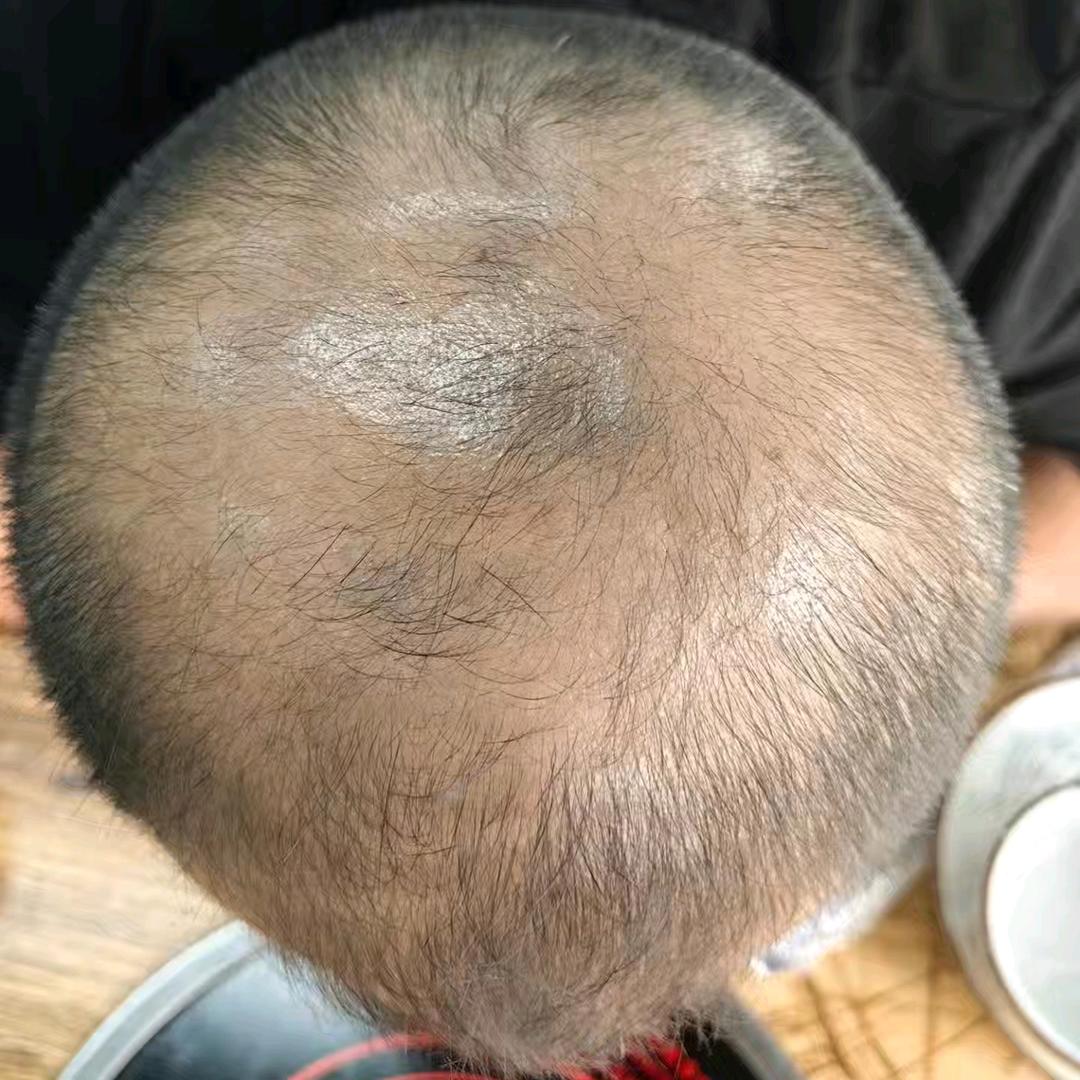 小咪