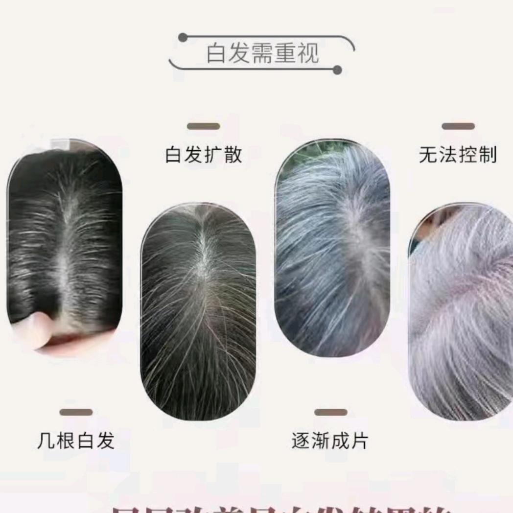 中药调理各种头皮问题（白转黑掉发脱发头油