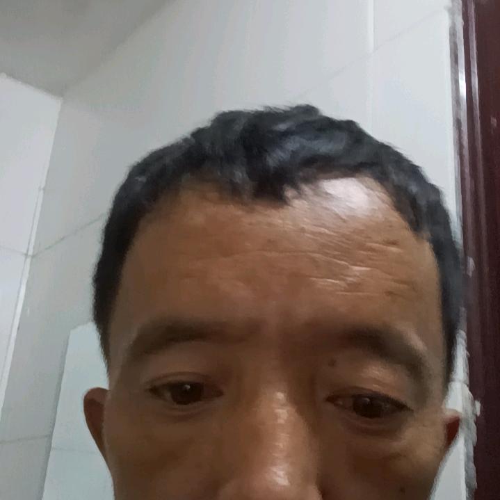 雷晓红