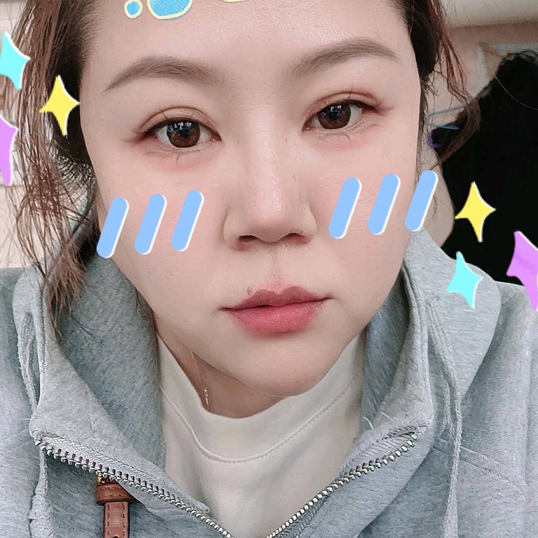 玲儿