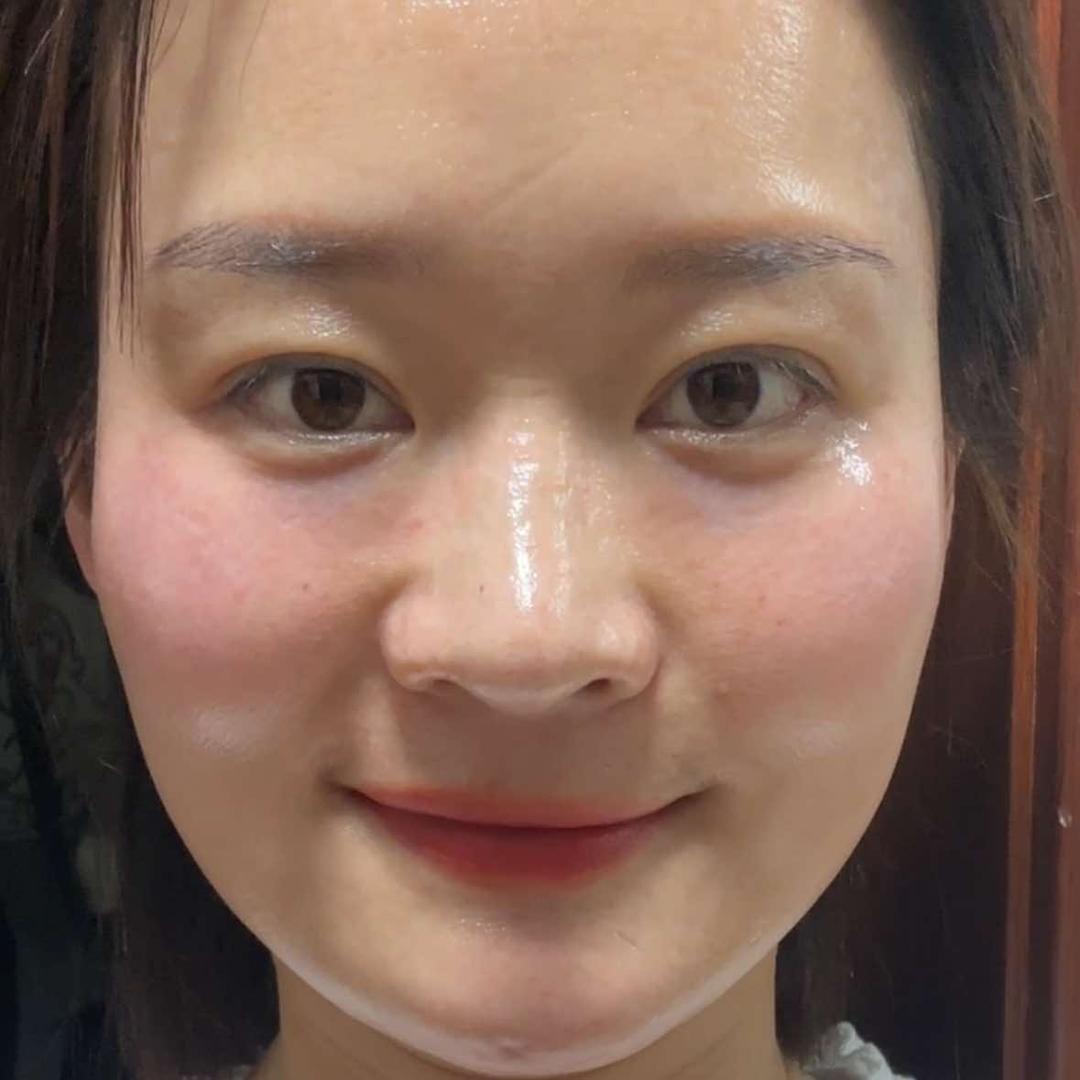 赵晓凡脸不干净找我
