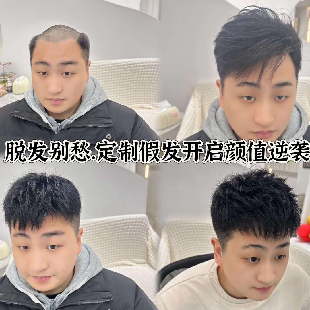 焕新补发专业男士定制假发