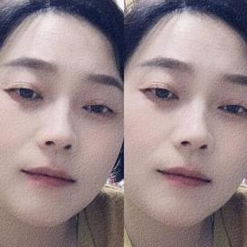 赵小玲问题皮肤管理