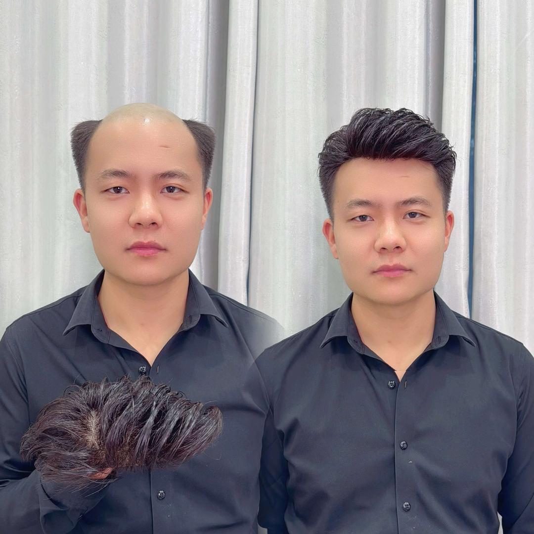 颖嘉美假发补发店官方号