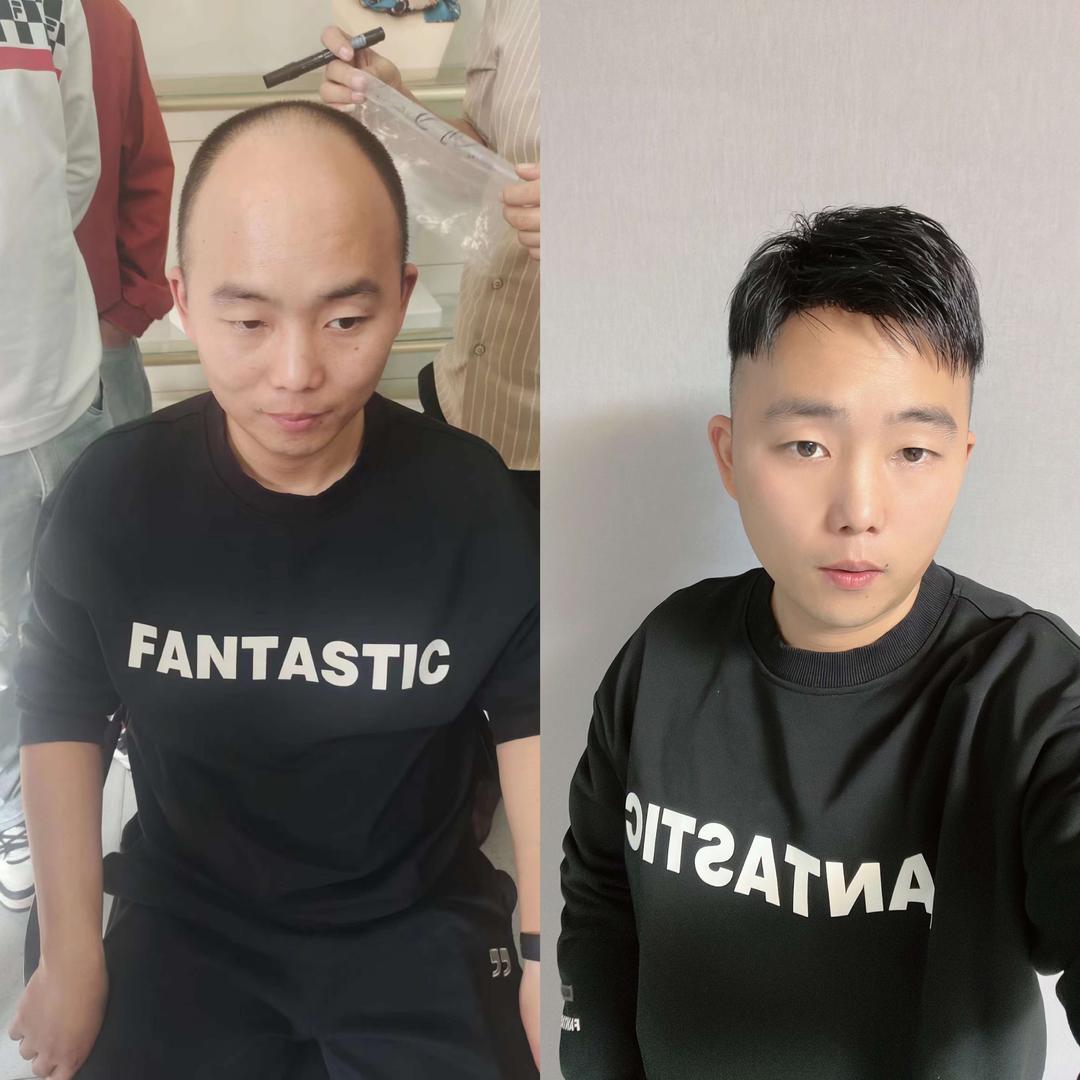 厘米假发定制