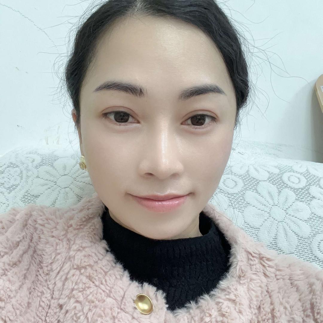 深圳龙华民治痣疣美业阿华