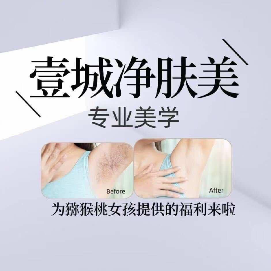 在梧州做脱毛的A娜