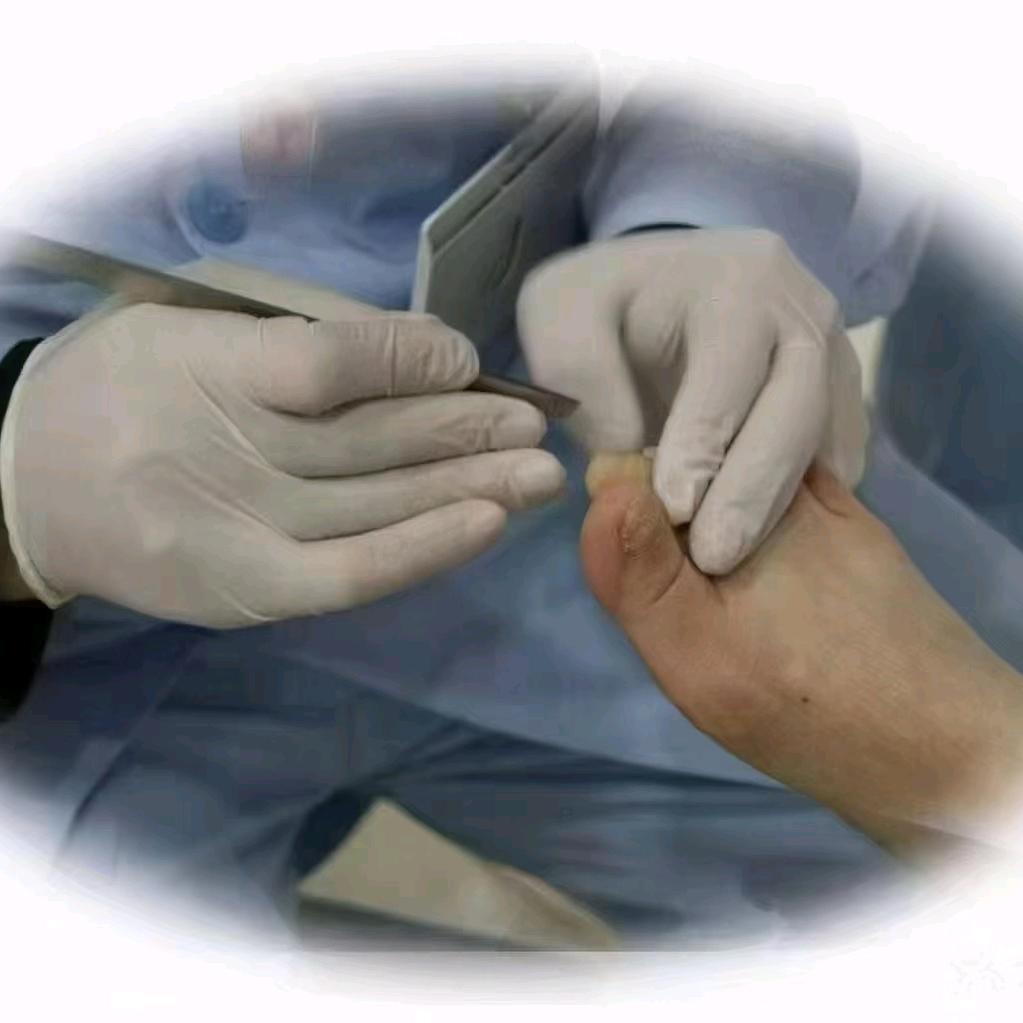 趾康修脚官方号