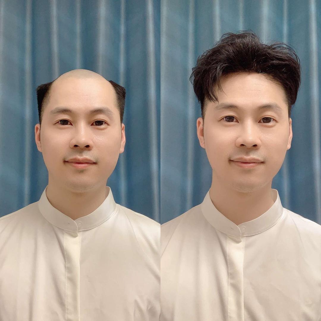 宁国  阿明假发